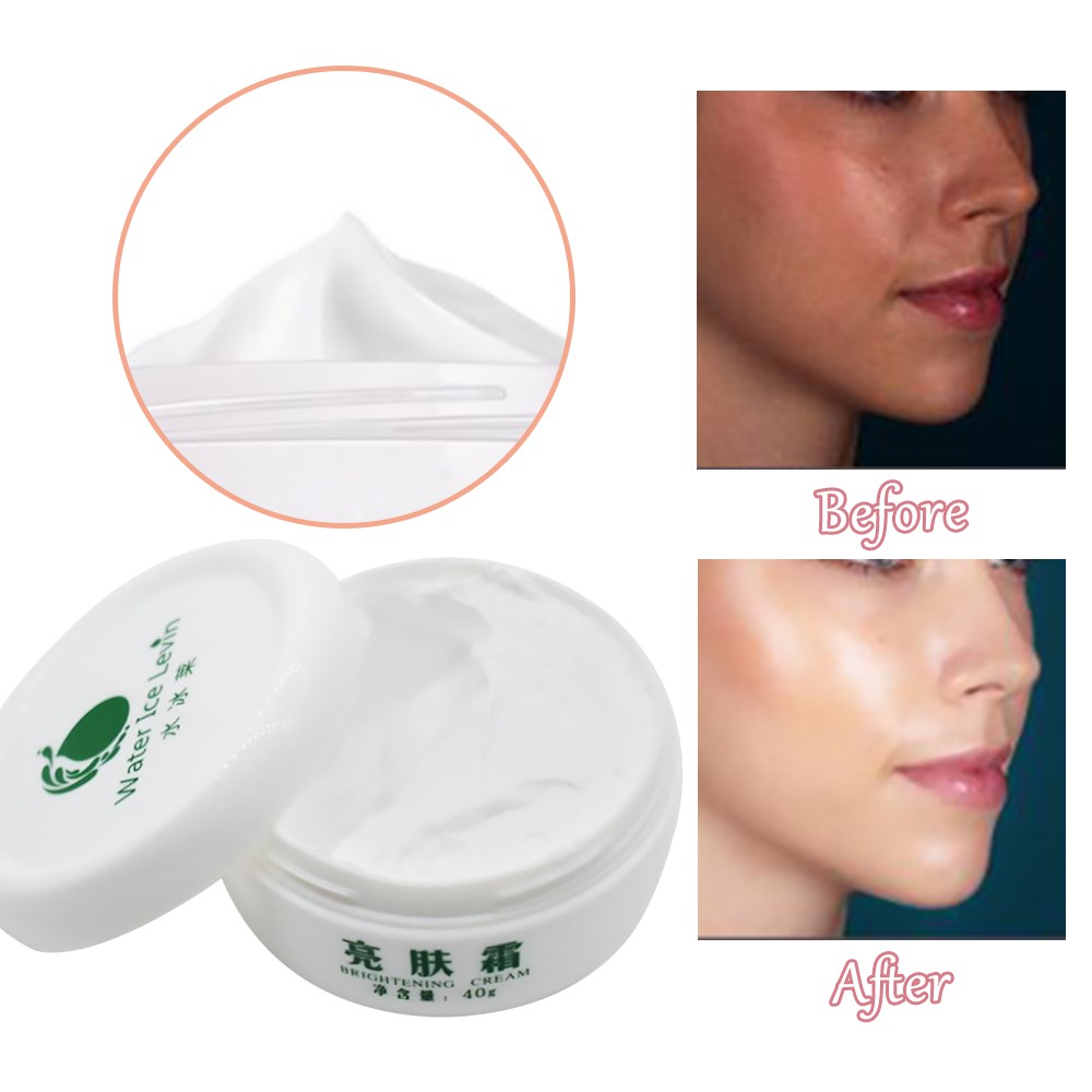 bleaching cream to remove dark spots