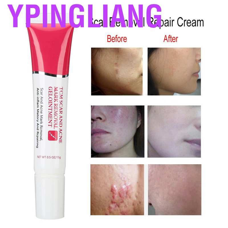 dark scar removal cream