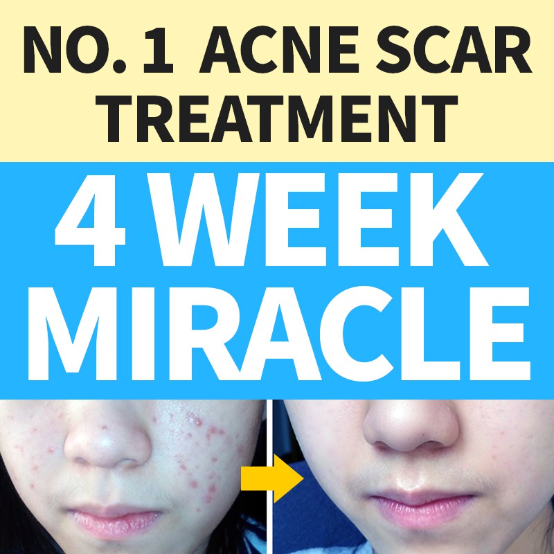 snail cream for scars