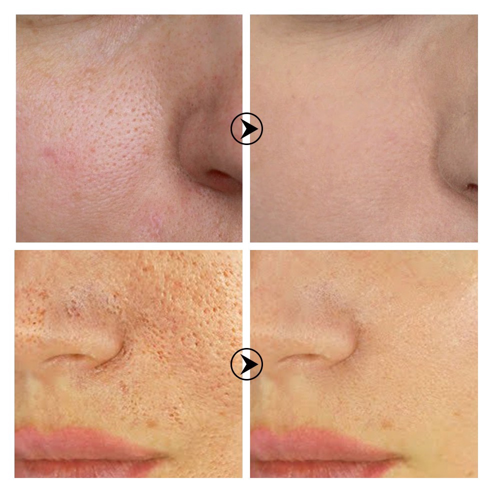 breylee pore refining serum price
