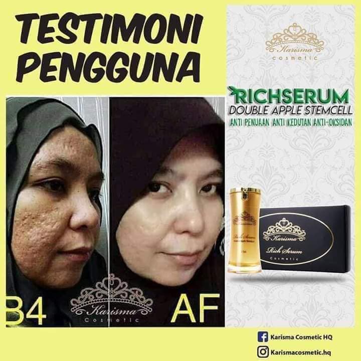 testimoni karisma skincare