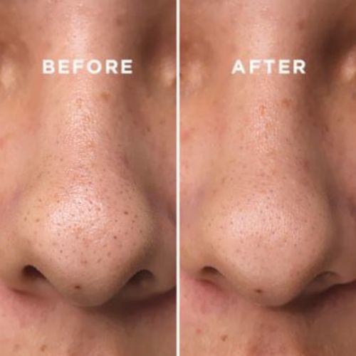 Cosrx Bha Blackhead Power Liquid 100ml Cocomo Shopee Singapore