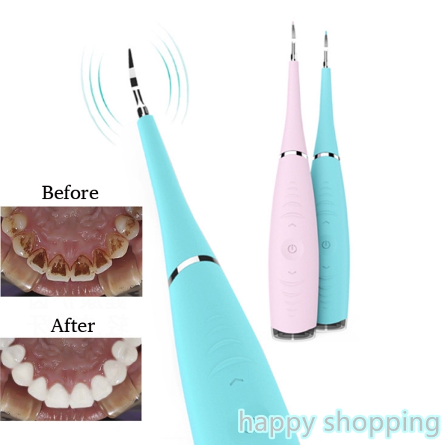 portable sonic dental tooth stain remover