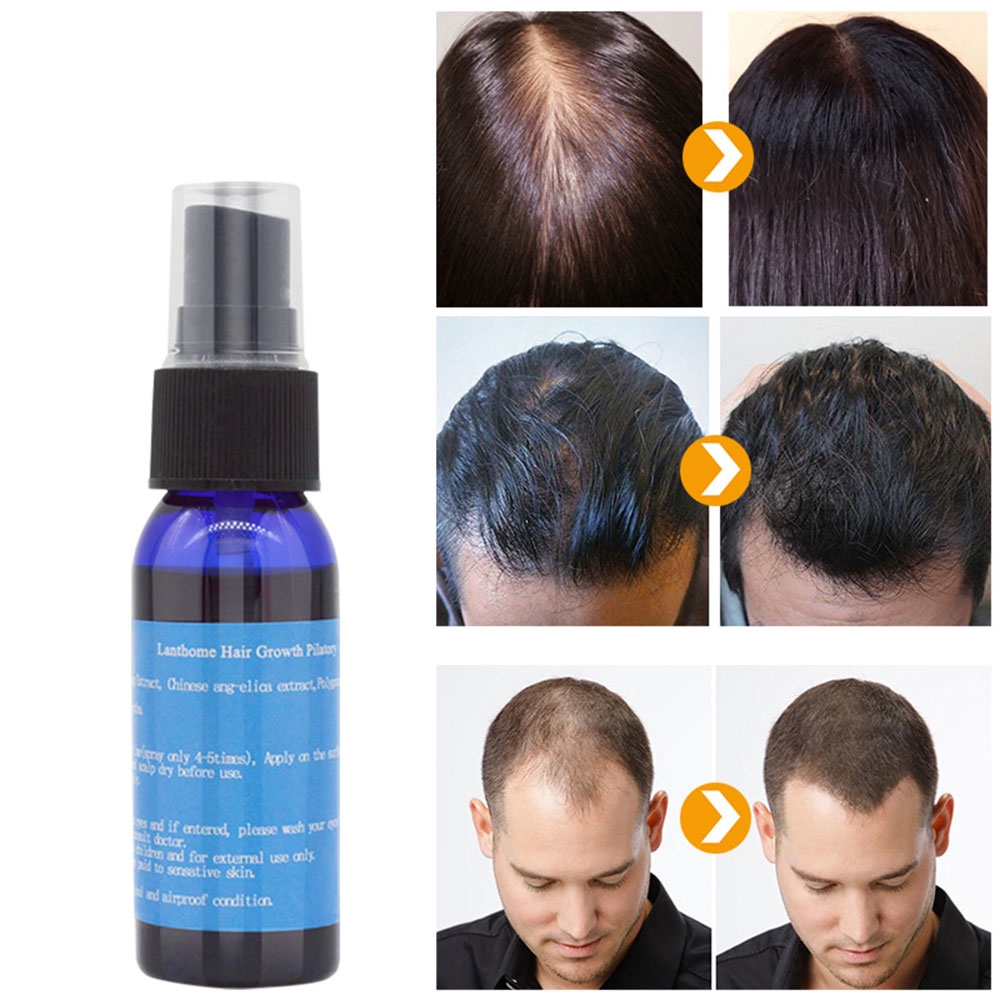 Hair Growth Essential Oil Spray Fast Grow Hair Root Nourishment
