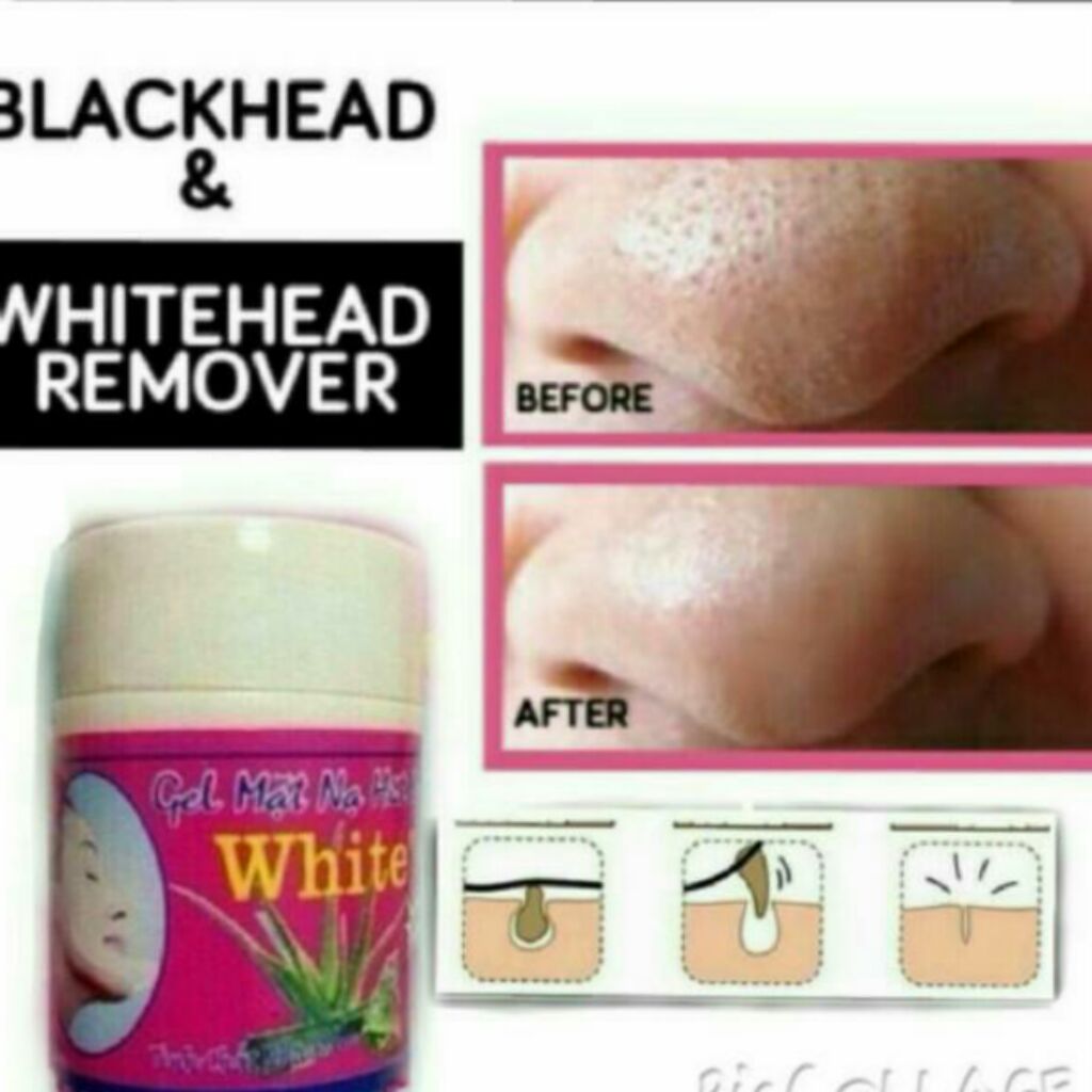 Vietnam White Mask Whitehead And Blackhead Remover Gel Hut Mun Shopee Singapore 2866