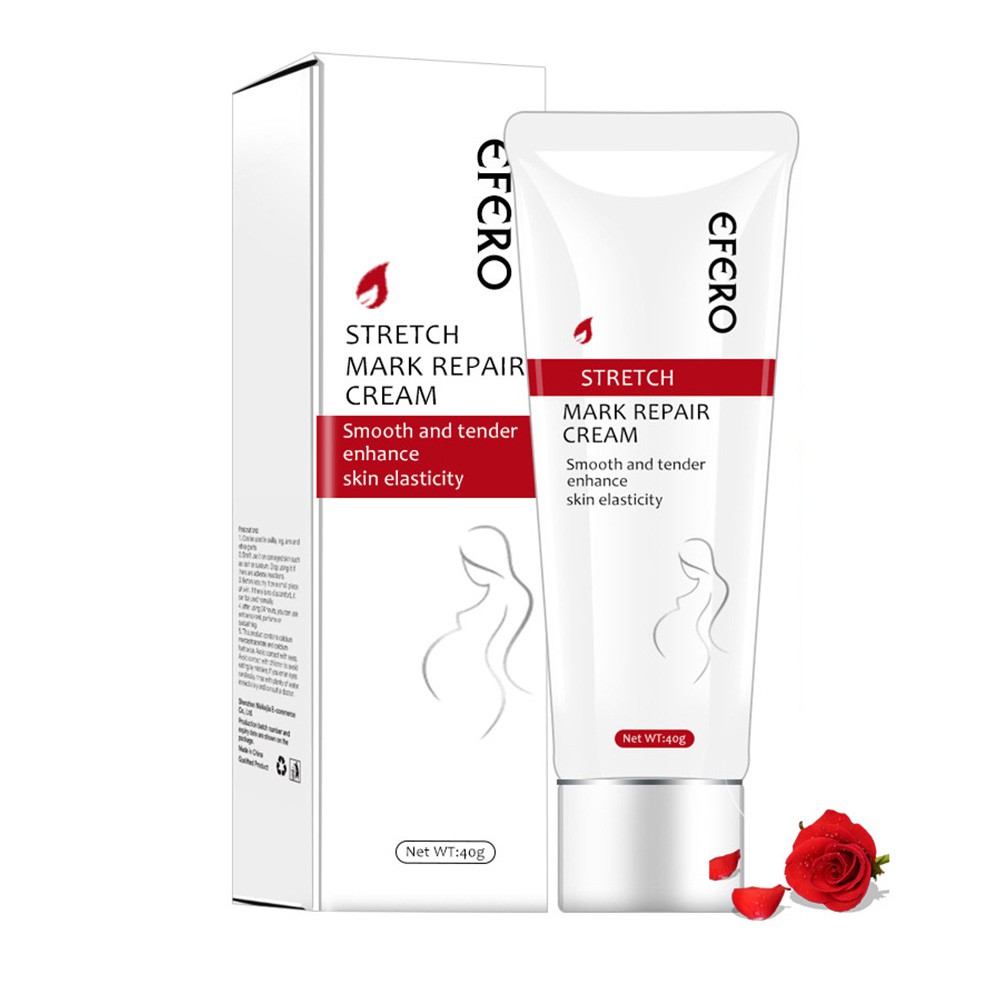 stretch mark lightening cream