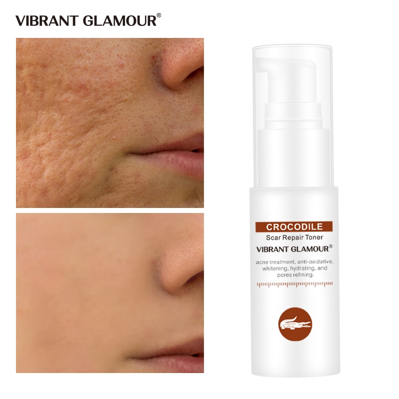 crocodile face toner