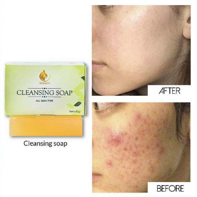 effective soap for scars