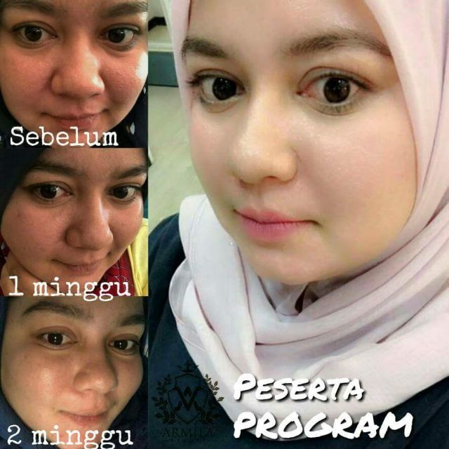 feedback kak ell skincare
