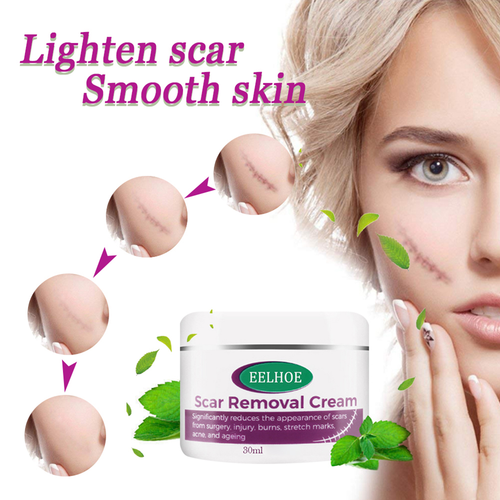 stretch marks ointment cream