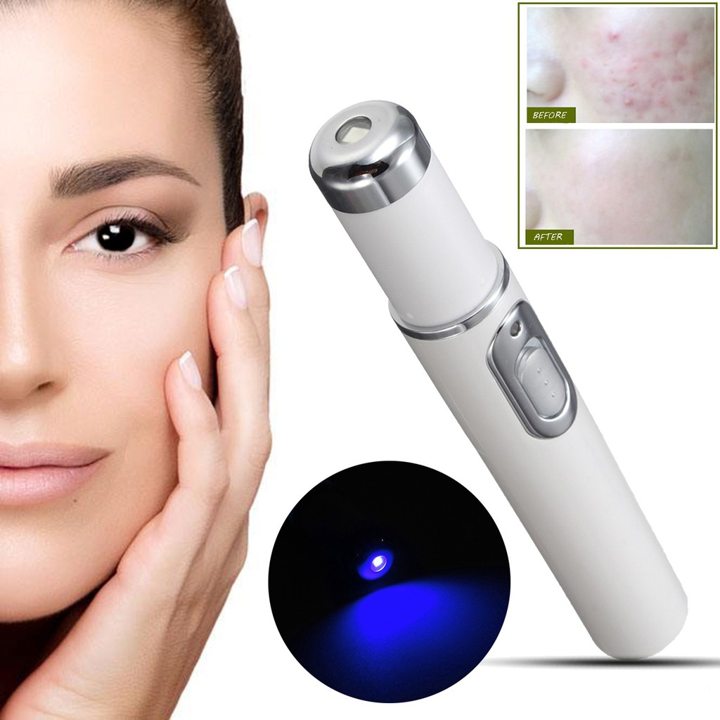light therapy for acne