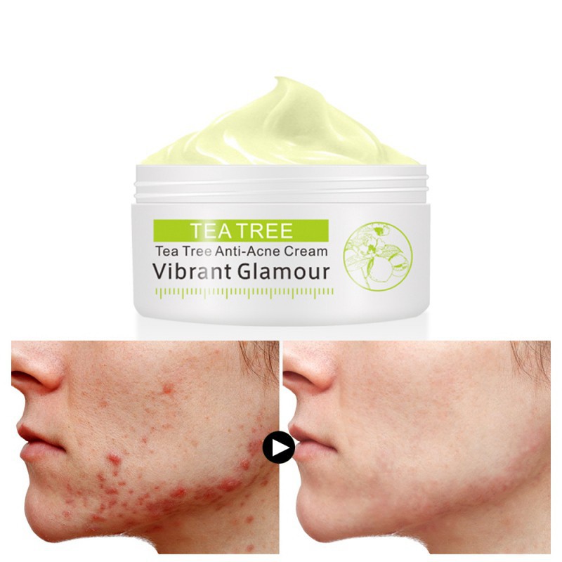 blemishes cream treatment