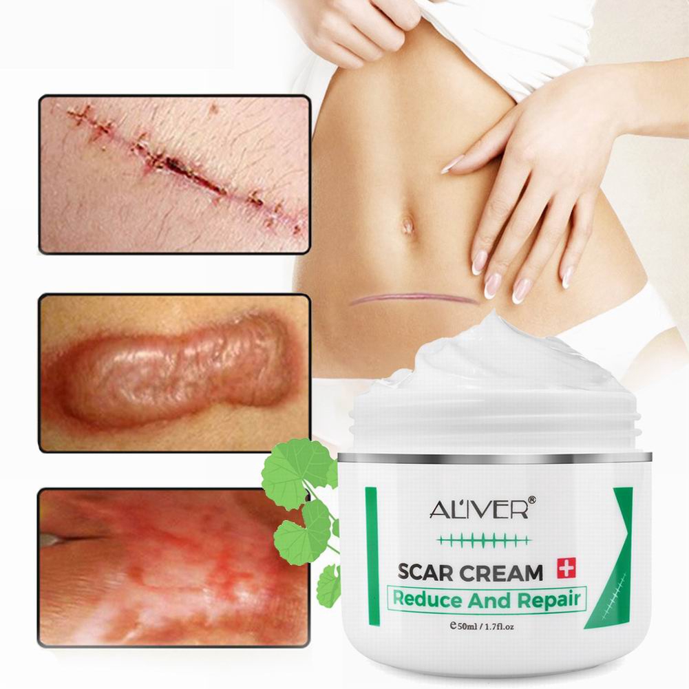pimple scar cream