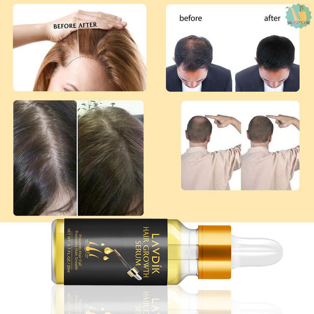 LAVDIK Hair Growth Serum Hair Loss Treatment Prevention Liquid for Hair