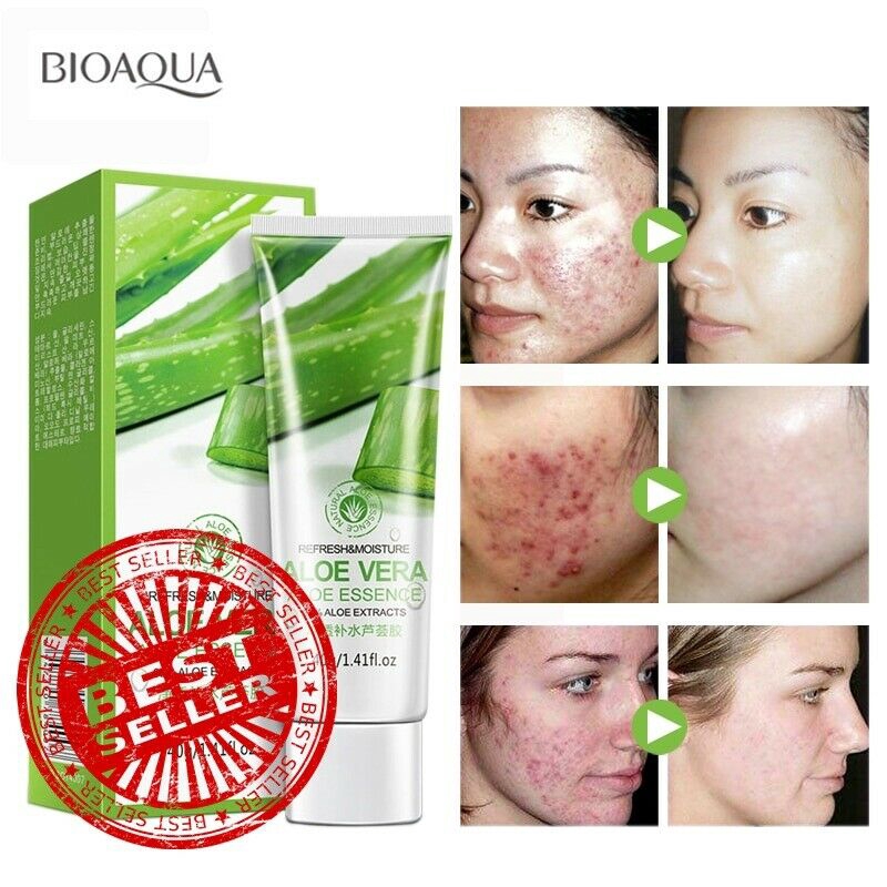 aloe vera gel moisturiser