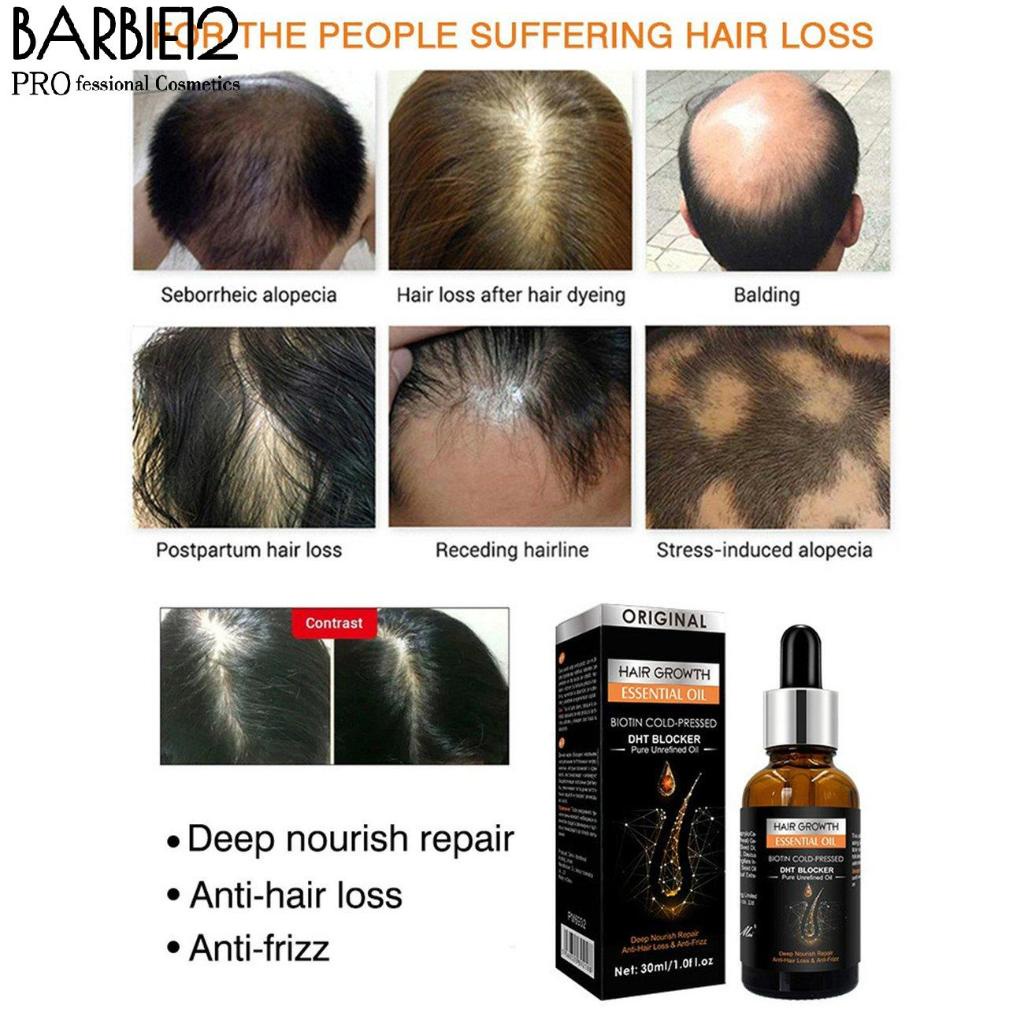 Hair Growth Essential Oil Biotin Cold-Pressed DHT Blocker and Hair Growth  serum Anti-Hair Loss Conditioner | Shopee Singapore