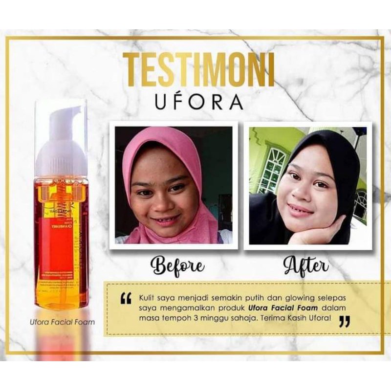 Ufora Skincare Set Original Hq Shopee Singapore