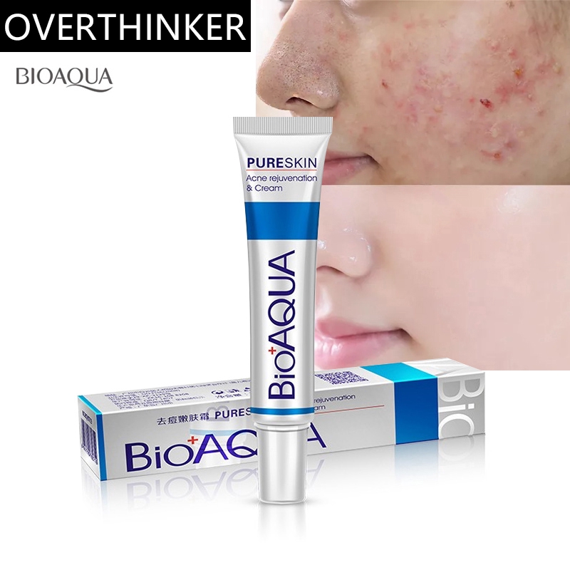 acne cream moisturizer