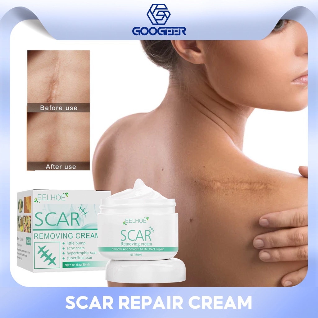 EELHOE Scar Removal Cream Effective Removes Acne Pimples Stretch Mark