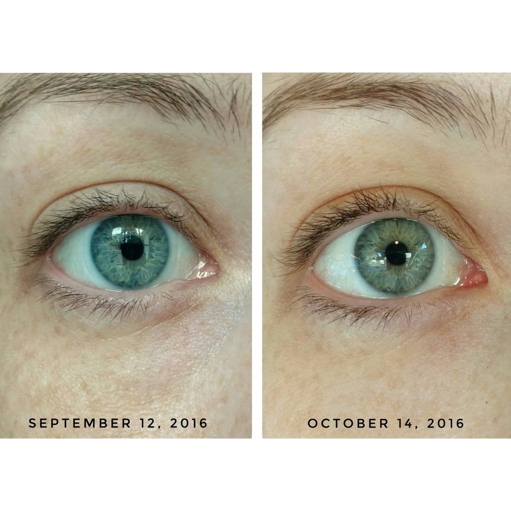 it bye bye under eye eye cream
