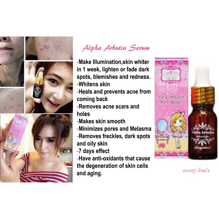 alpha arbutin for acne prone skin