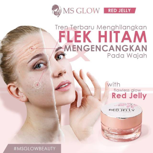 Ms Glow Red Jelly Msglow Acne Cream Spots Cream Extra Glowing Cream Shopee Singapore
