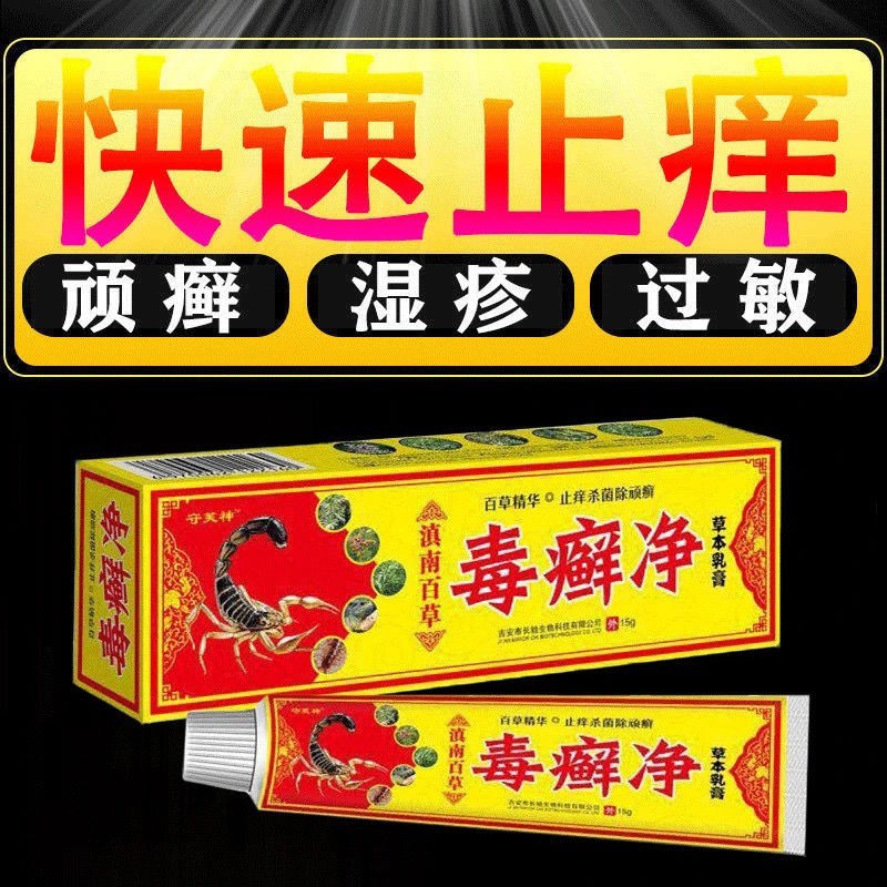 ┇Hands, feet, feet and head ringworm private parts itching dermatitis