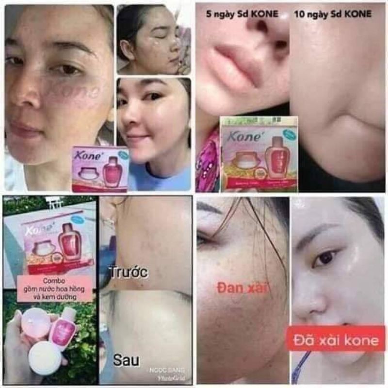 kone skincare original