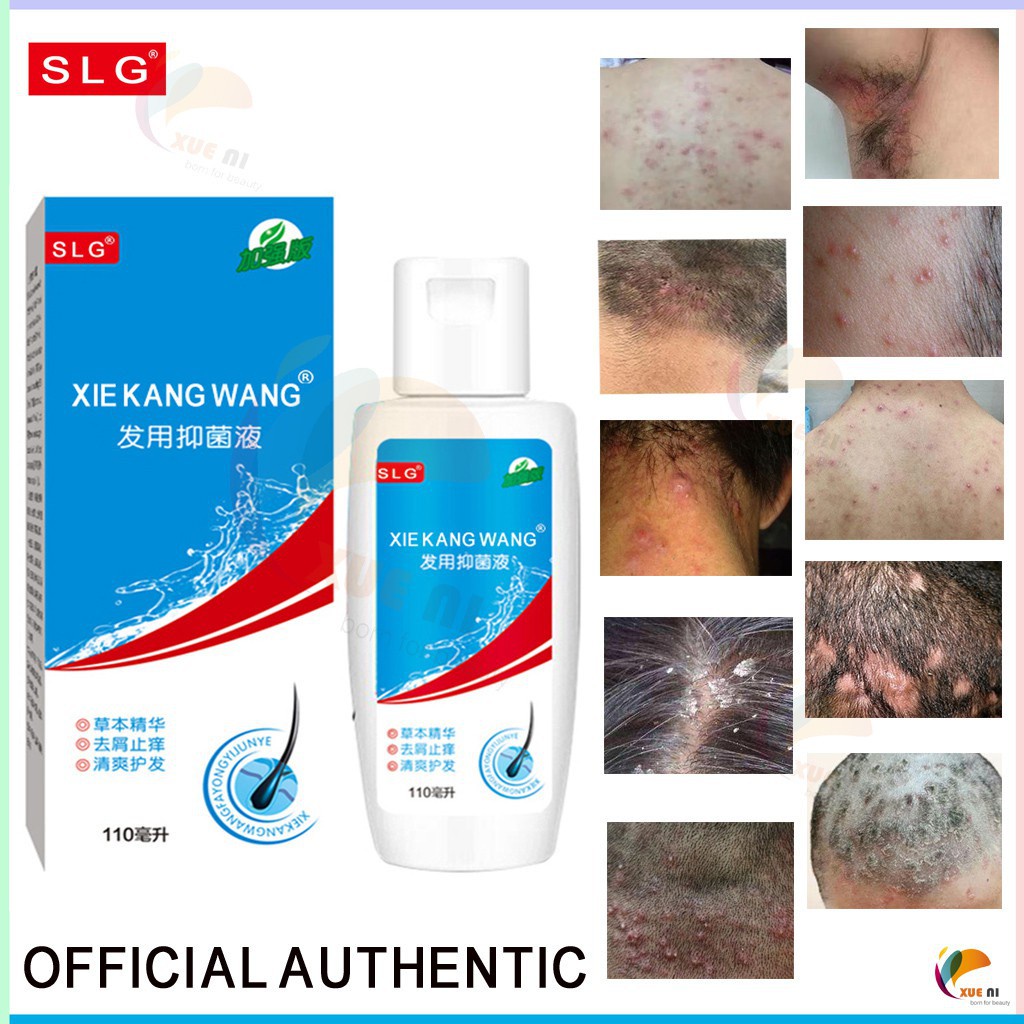 OFFICIAL AUTHENTIC SLG Scalp seborrheic dandruff psoriasis