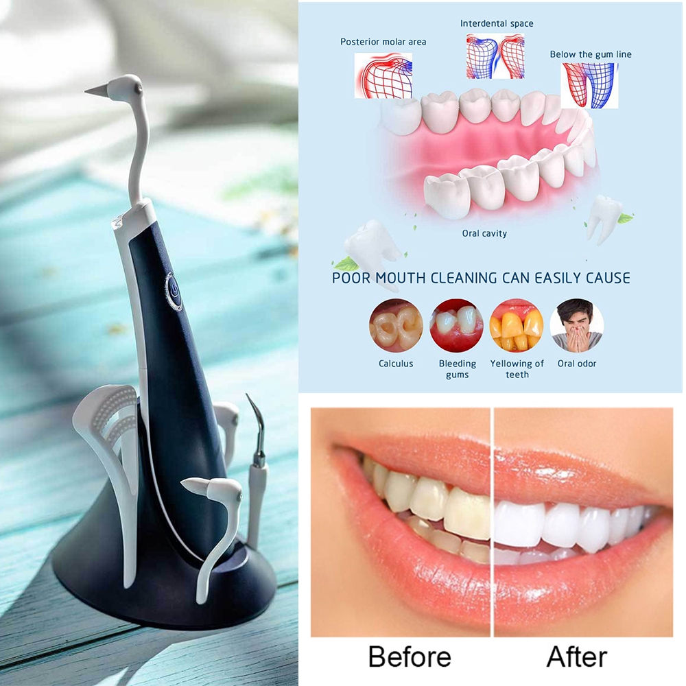 sonic smile ultrasonic tooth cleaner