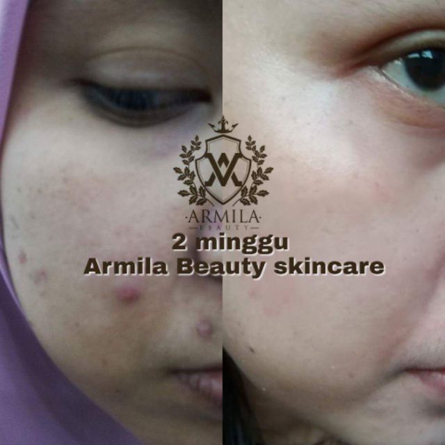 feedback kak ell skincare