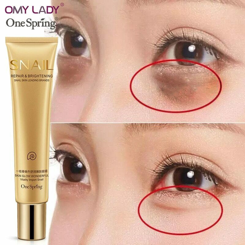dark eye remover