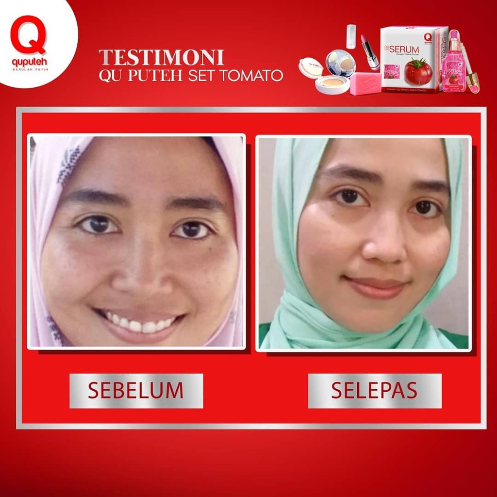 Dsv Qu Puteh Tomato Serum Combo Sale Shopee Singapore