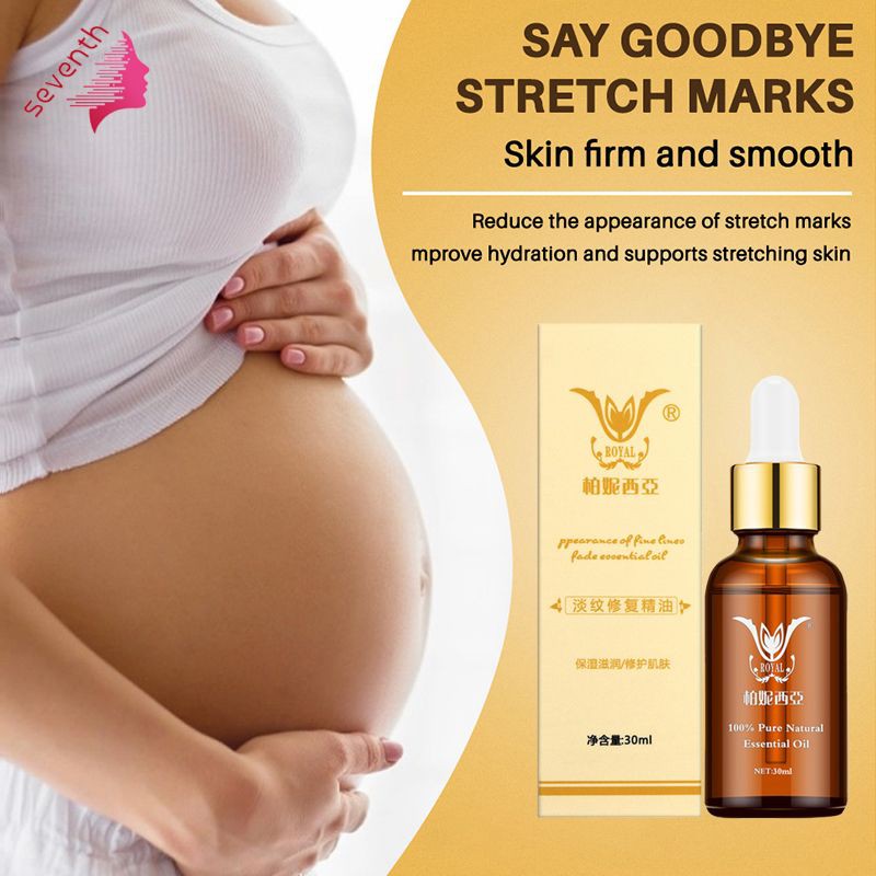 postpartum stretch mark removal