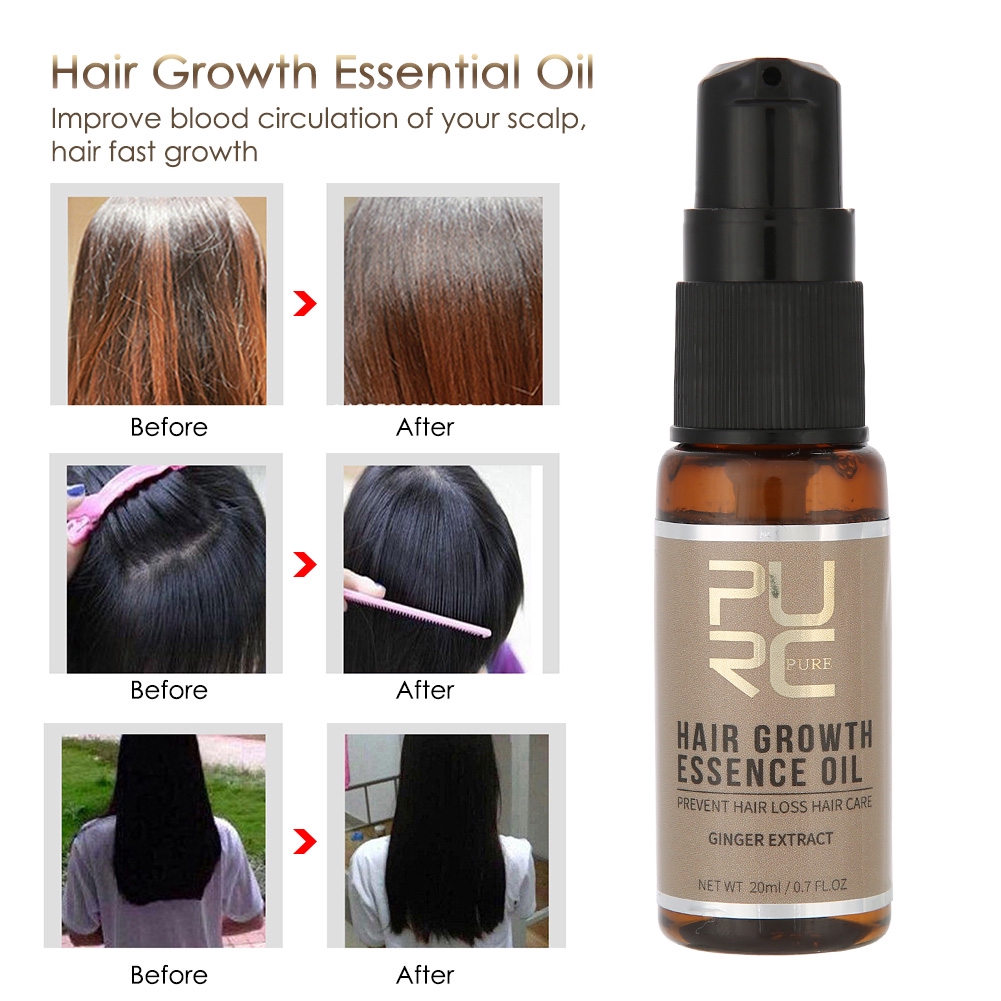 Fast Hair Growth Essence Oil Liquid Ginseng Nourish Scalp Hair Loss  Treatment