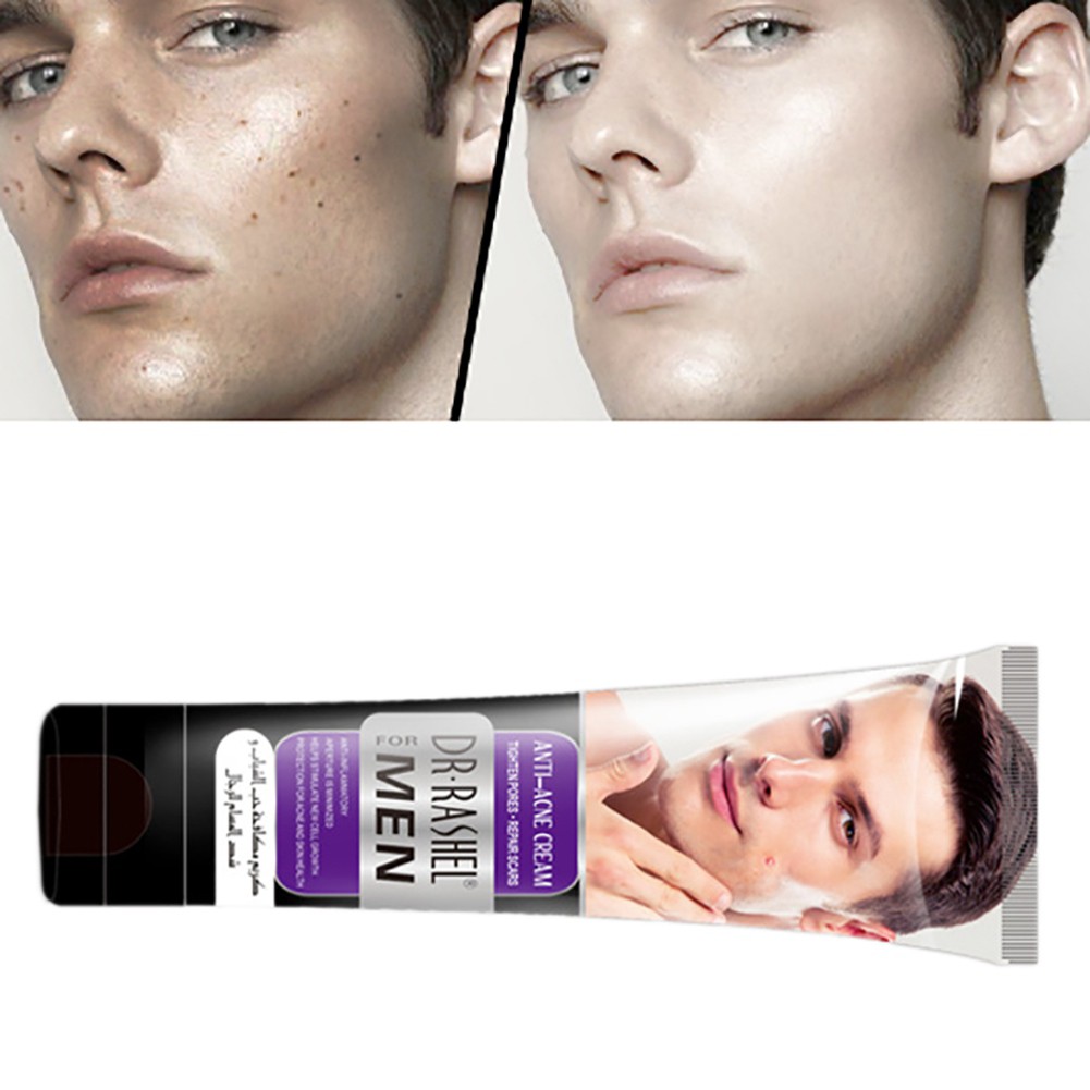 men's acne scar treatment