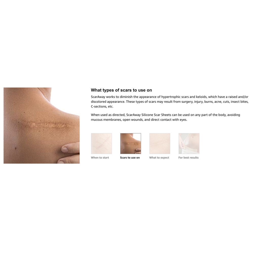 silicone patches for scar tissue