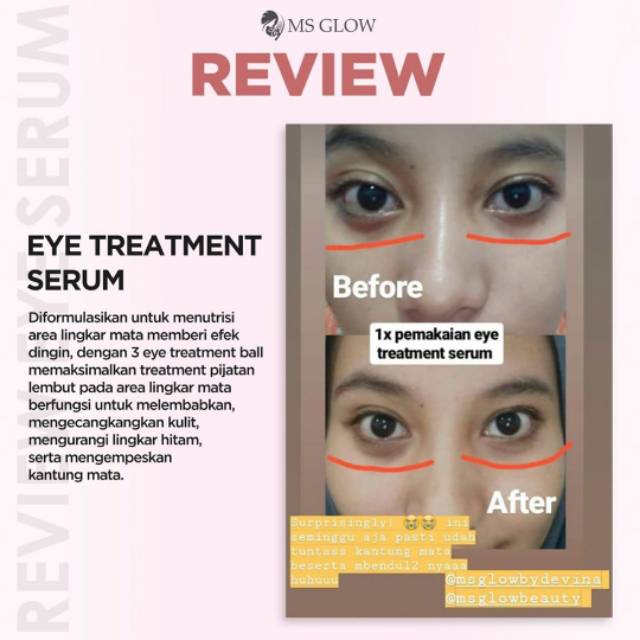 eye glow serum