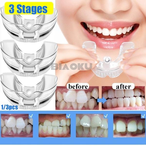 【HOT SALE】3 Stages Dental Orthodontic Braces Appliance Braces Alignment Trainer Teeth Retainer
