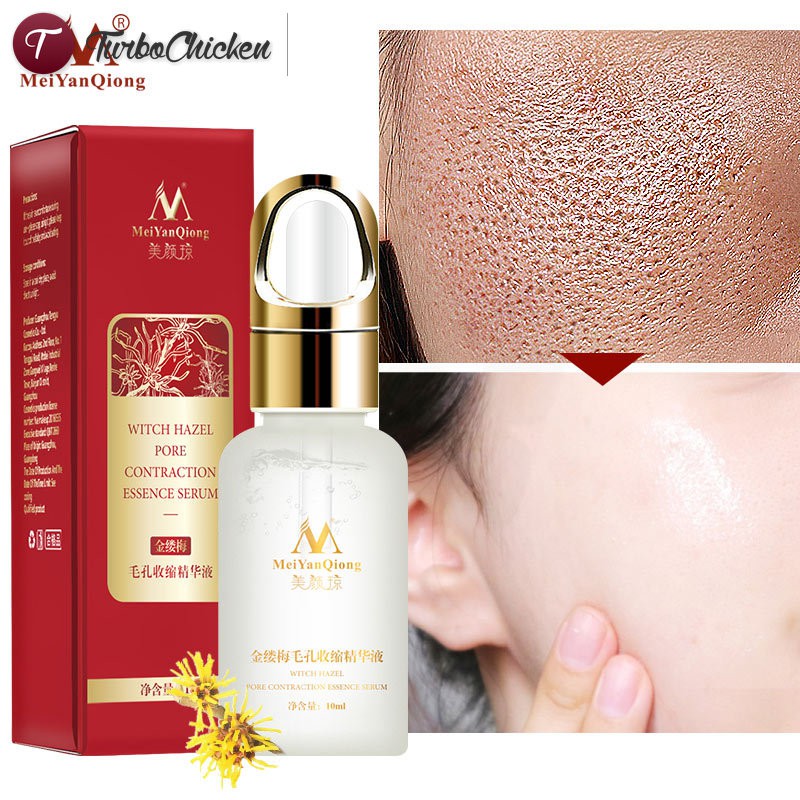 witch hazel and skin care