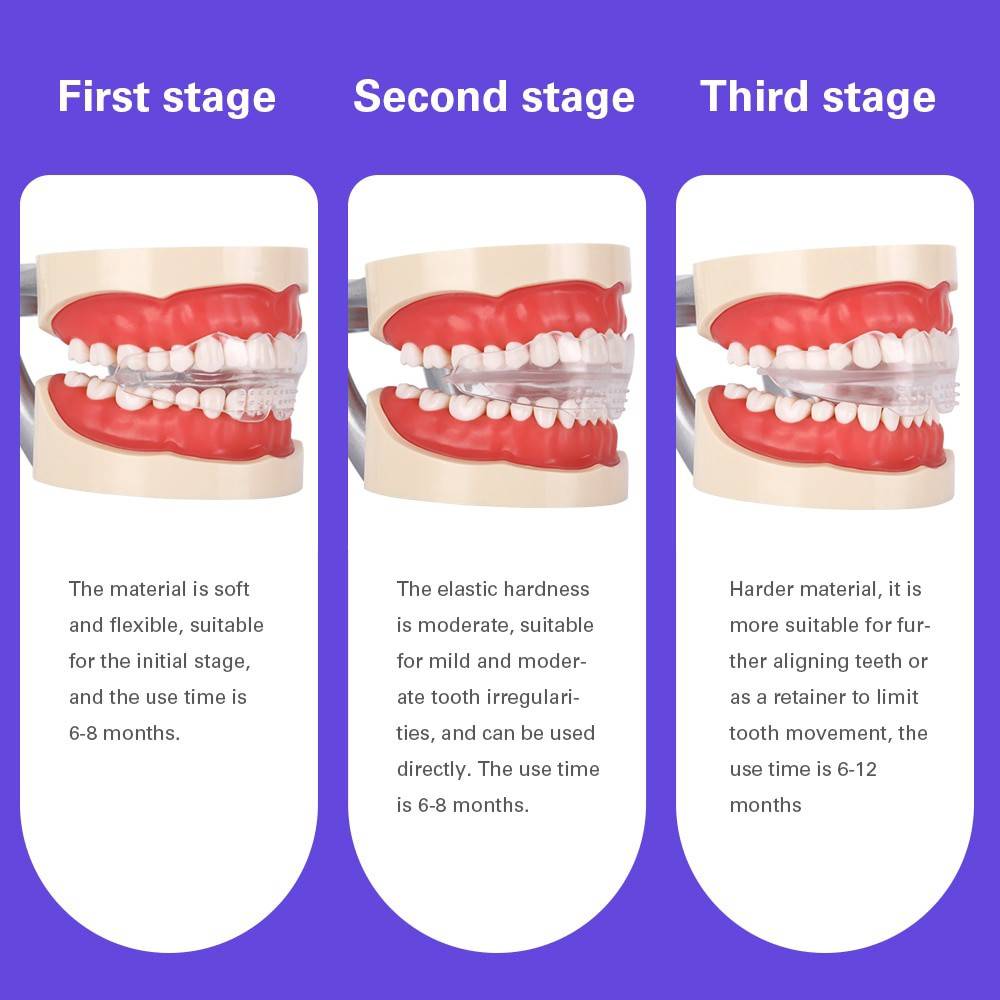 3pcs/set Children Dental Tooth Orthodontic Appliance Trainer Kids Alignment  Alignment Braces Oral Hygiene Dental Straight Teeth Care | Shopee Singapore