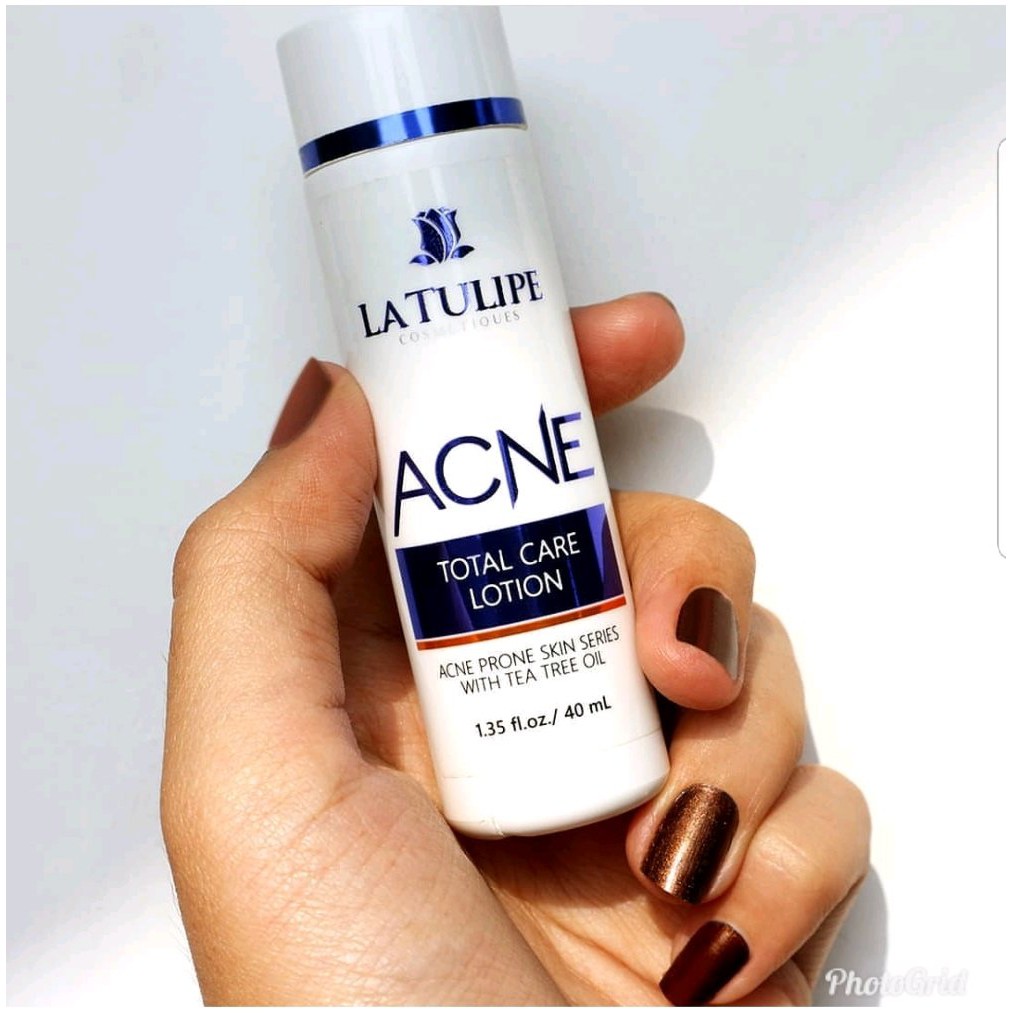 la tulipe acne total care lotion