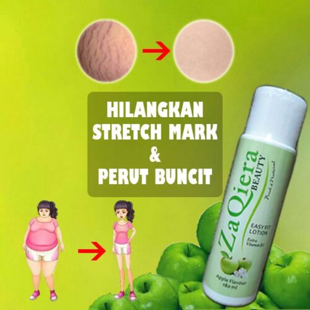 Losyen Kurus Cellulite Reducing Stretch Mark Stomach Buncit Stomach Shopee Singapore