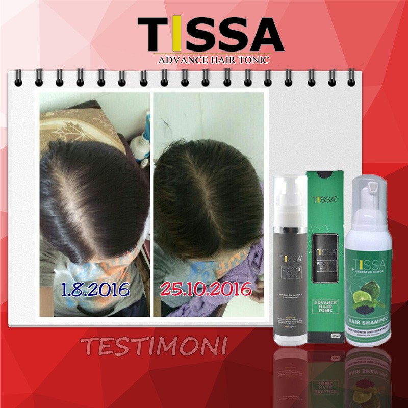 Shop Malaysia Tissa Advance Hair Tonic Original Hq Shopee Singapore