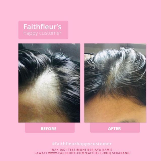 Hair Scalp Tonic Faith Fleur Shopee Singapore