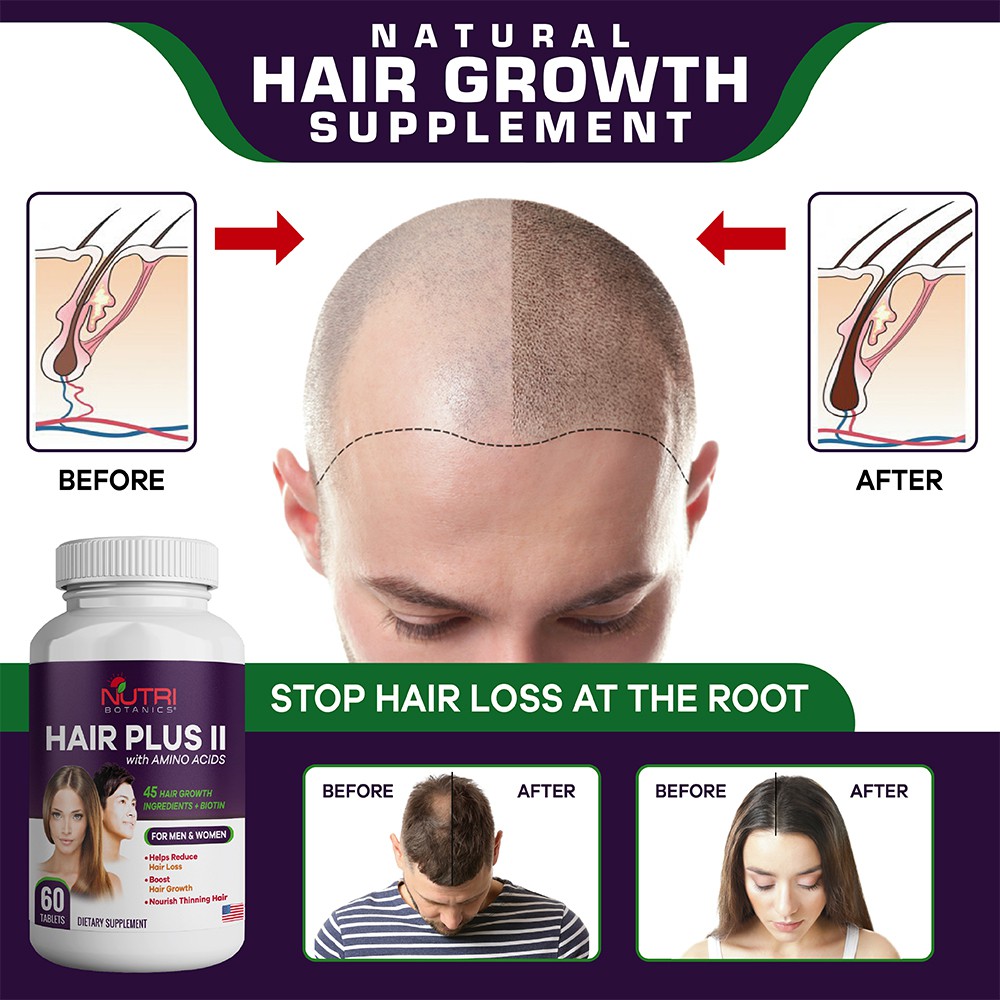 Hair Plus II with Amino Acid, Biotin - Hair Growth Supplement, 45 Hair  Vitamin, Stop Hair Loss - Men & Women - 60 Tablet | Shopee Singapore