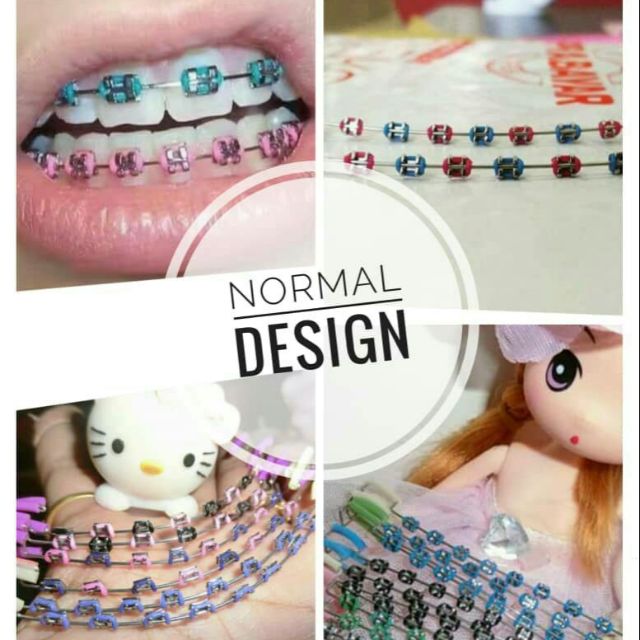 Braces Click Viral Atas Bawah ( Normal Design ) Shopee Singapore