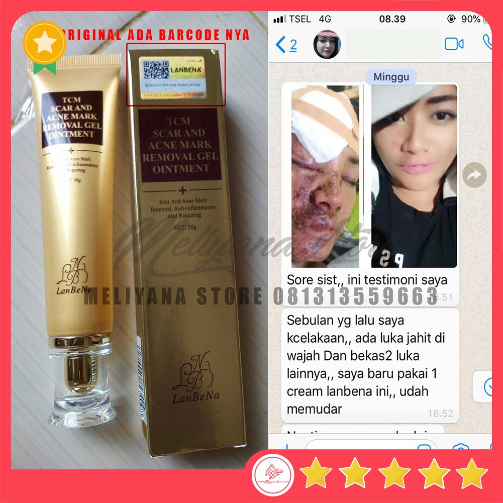 tcm acne scar removal cream price