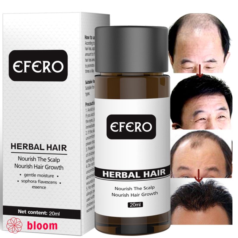 Hair Loss Serum Dense Hair Growth Serum Prevent Baldness Anti Hair