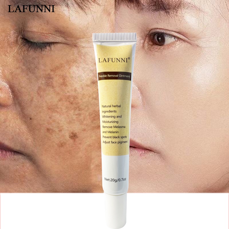 LAFUNNI Whitening Freckle Cream Face Moisturizing Remove Dark Spots Melanin Melasma Remover